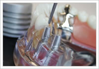 �C���v�����g